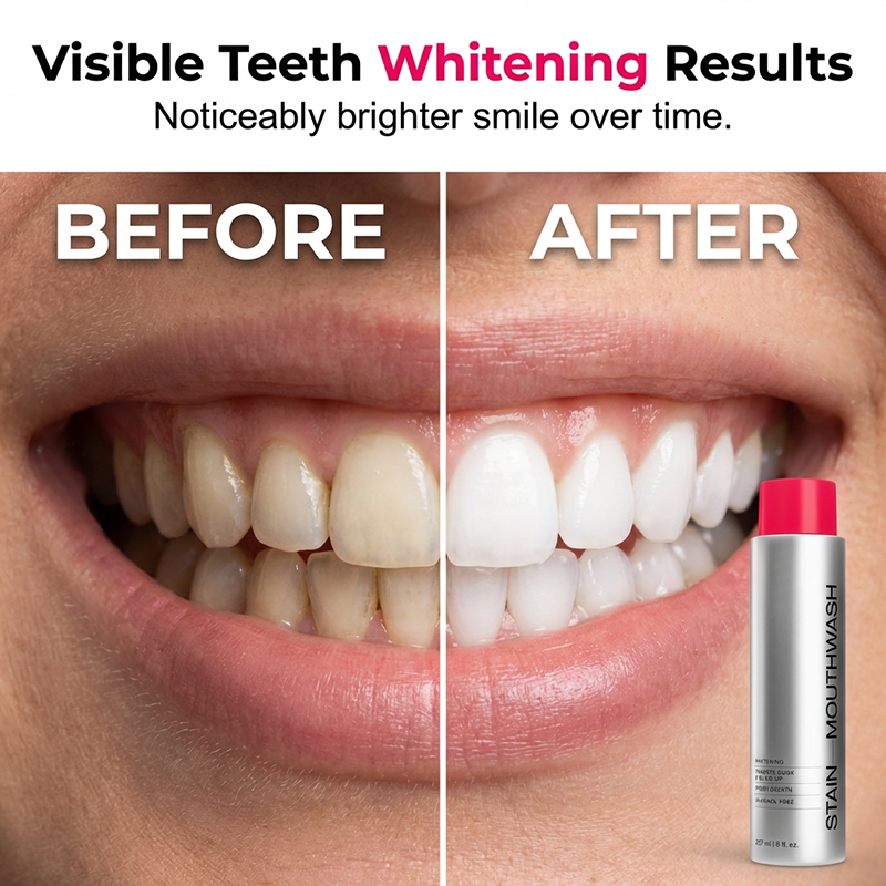 😁50K+ SOLD!🦷40% OFF! ☕Stain‑Removing Whitening Mouthwash – Lifts coffee & tea stains, alcohol‑free. Instant gunk binding, long‑lasting minty fresh. Gentle enough for daily use. 🦷
