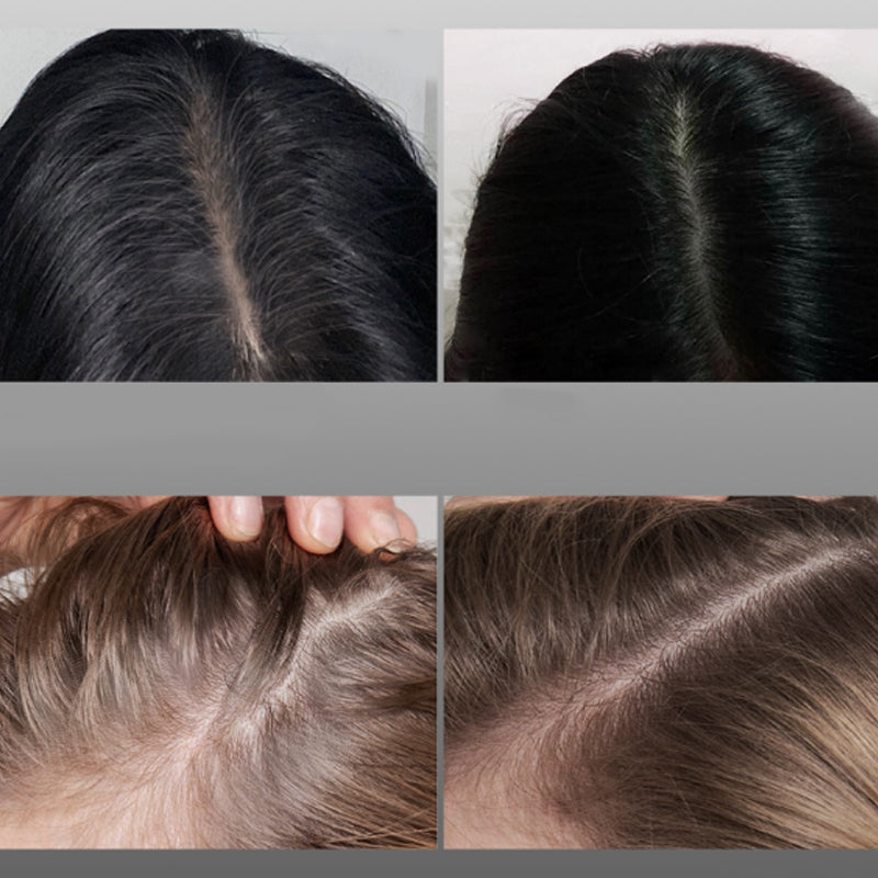 💇‍♂️ BUY 1 GET 1 FREE! ✨ Waterproof Hair & Beard Filler Pen – Instant Grey Coverage, Comb Applicator 🖌️