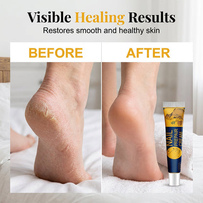 Moisturizing Anti-Crack Repair Foot Cream