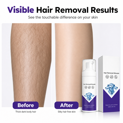 Gentle Hydrating Hair Removal Mousse for Body Hair